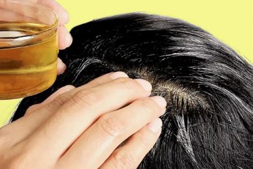 Витамины для волос: как избавиться от выпадения